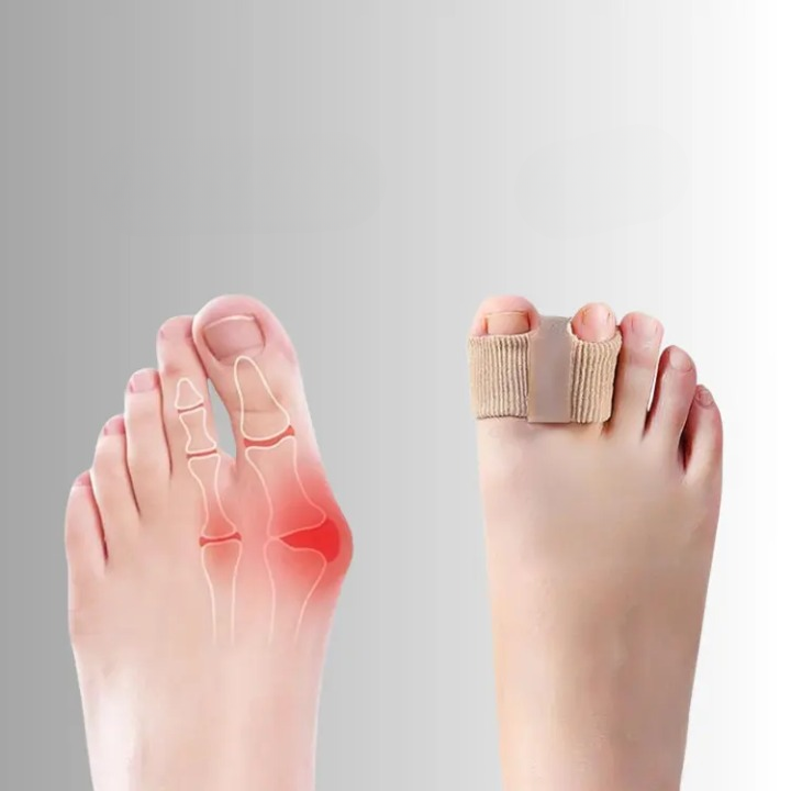 Toe Aligner Silicone Gel Bunion Correction
